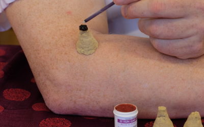 Moxibustion