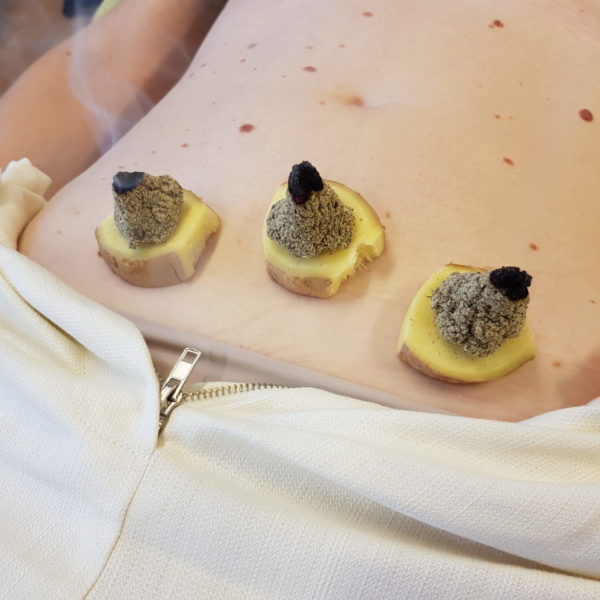 formation moxibustion